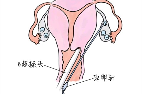 http://nanning.vdtfzz.com/post/205.html|南宁供卵助孕